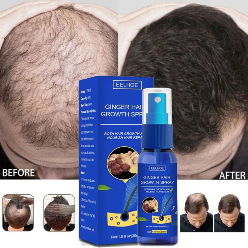 Hair Care Essence Oil Spray - Ginger Hair Growth Serum Spray Anti