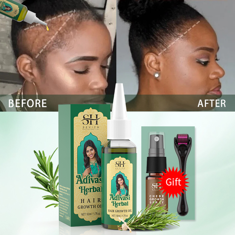 Ayurvedic Hair Growth Oil Indi - Hair Care Fragrance Essential Oil recension och pris