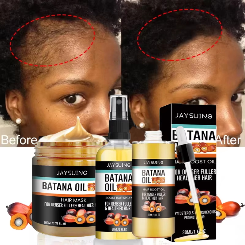 Batana Oil Thick Hair Serum Sp - Hair Care Essence Oil Spray recension och pris