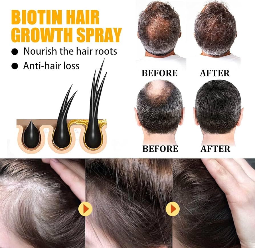 Batana Oil Thick Hair Serum Sp - Hair Care Essence Oil Spray recension och pris