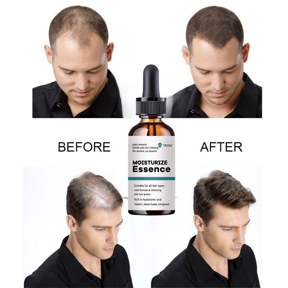 2022 New Hair Growth Essence P - Hair Care Ordinary recension och pris