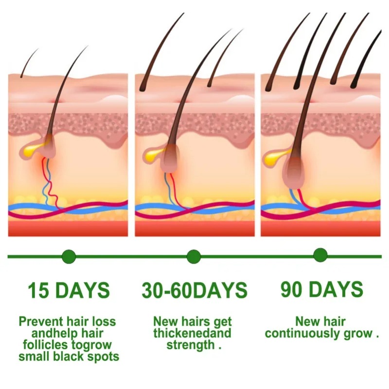 Hair Growth Serum Fast Growing - Hair Care Fragrance Essential Oil recension och pris