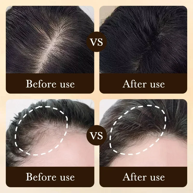 Biotin Fast Hair Growth Oil Pr - Hair Care Fragrance Essential Oil recension och pris
