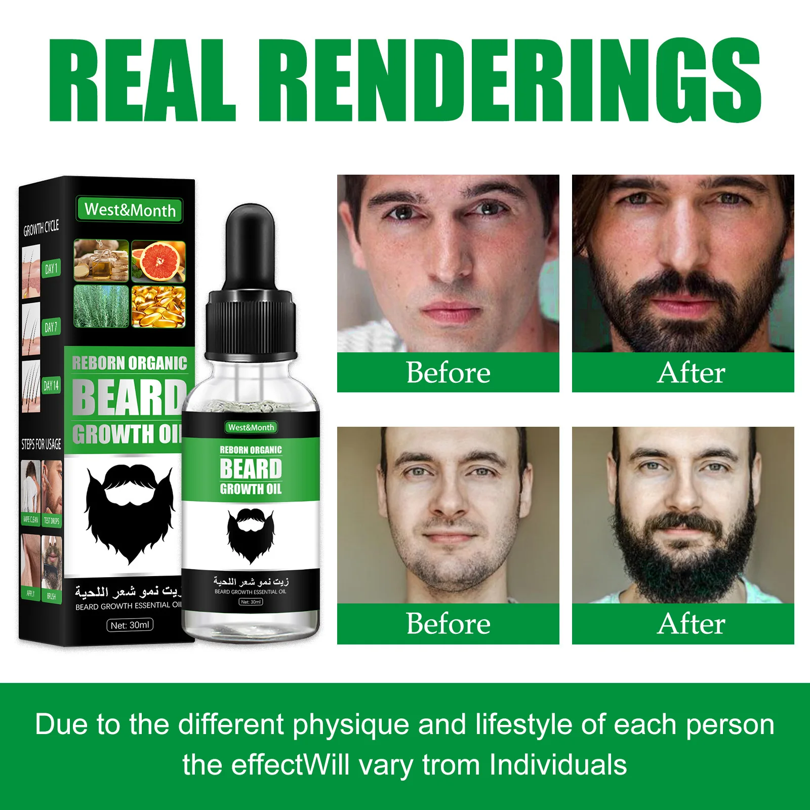 Men Beard Growth Roller Set Be - Hair Care Essence Oil Spray recension och pris