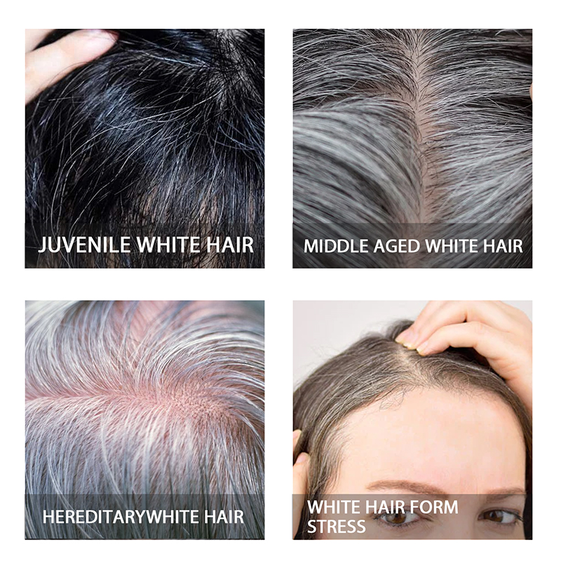 White Hair Treatment Darkening - Hair Care Essence Oil Spray recension och pris
